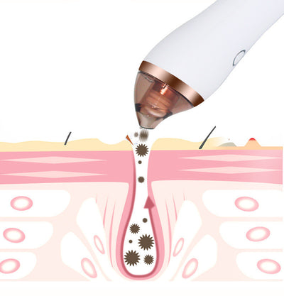Blackhead Vacuum Extractor