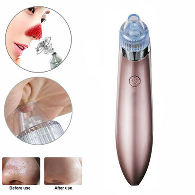 Electric Blackhead Vacuum Remover