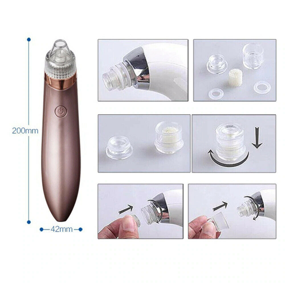 Electric Blackhead Vacuum Remover