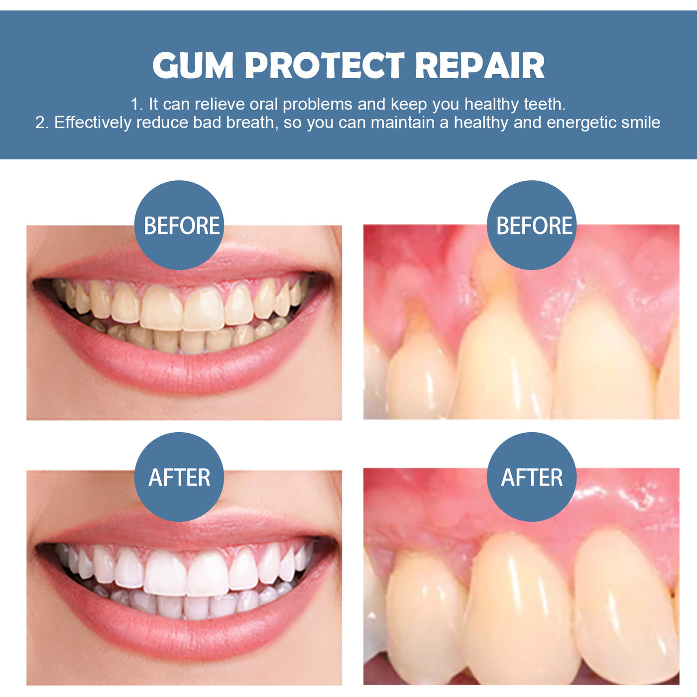 Gum Repair Set