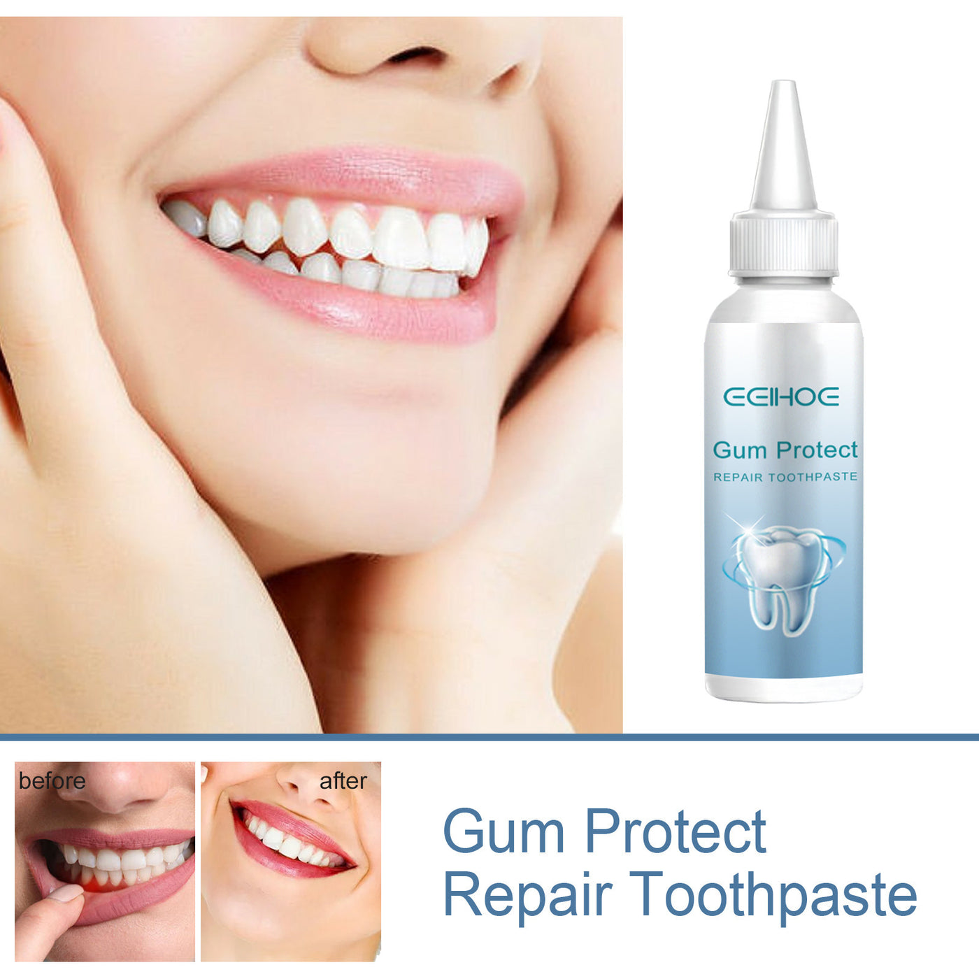 Gum Repair Set