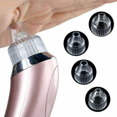 Electric Blackhead Vacuum Remover