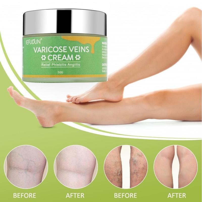 Vein Cream Treatment
